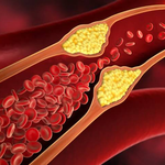 Tìm hiểu Cholesterol