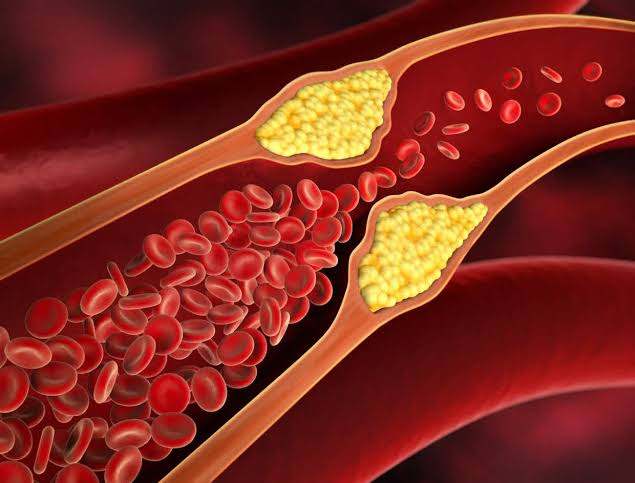 Tìm hiểu Cholesterol